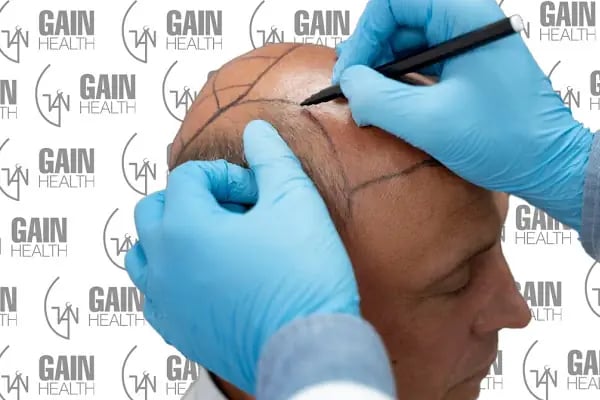 GAIN Internatıonal Sport-Healt - Resim 3
