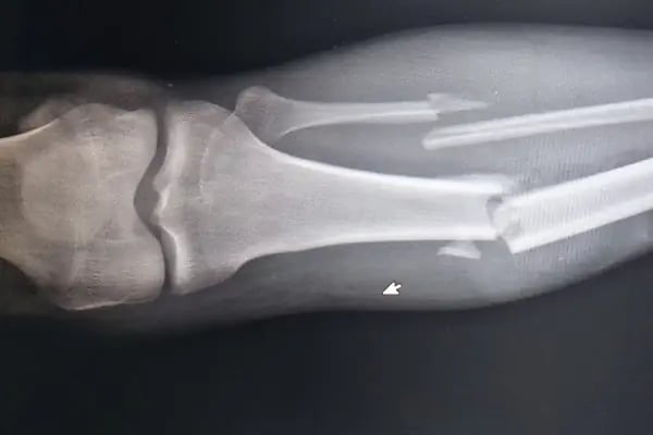Dr erhan karabuga - Resim 10