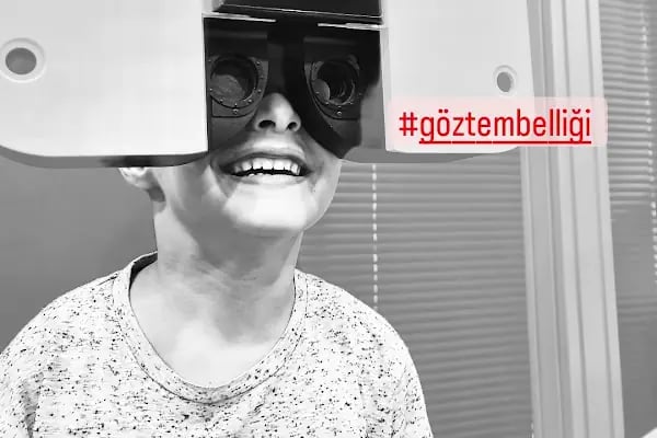 Op. Dr. Can Pamukcu Göz Kliniği, Göz Kapağı Hastalıkları ve estetiği, Protez Göz, Göz Tembelliği, Şaşılık, fraksiyonel lazer - Resim 18