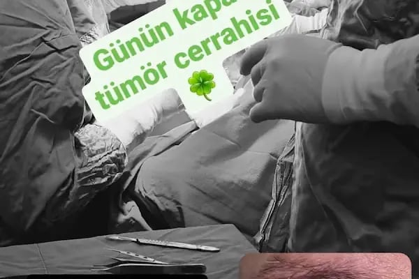 Op. Dr. Can Pamukcu Göz Kliniği, Göz Kapağı Hastalıkları ve estetiği, Protez Göz, Göz Tembelliği, Şaşılık, fraksiyonel lazer - Resim 5