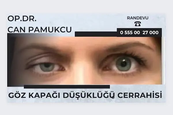 Op. Dr. Can Pamukcu Göz Kliniği, Göz Kapağı Hastalıkları ve estetiği, Protez Göz, Göz Tembelliği, Şaşılık, fraksiyonel lazer - Resim 17