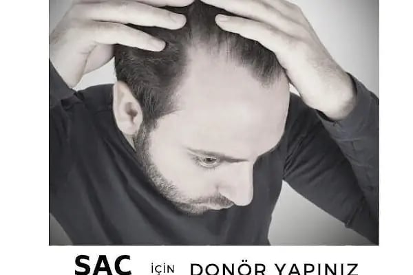 S Clinic Bursa - Saç Çoğaltma, Saç Bakım ve Güzellik Merkezi - Resim 17