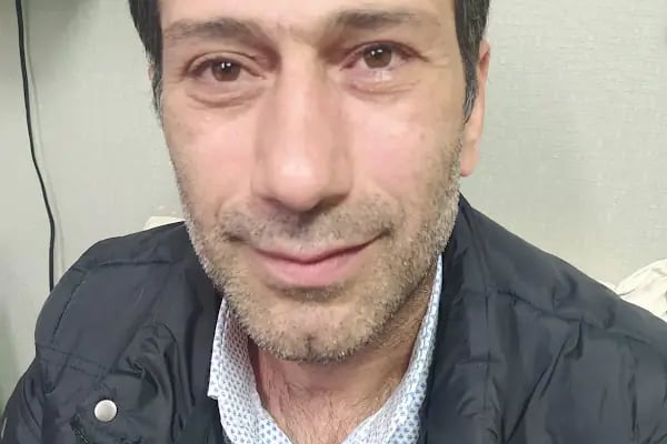 Saydam Protez Göz Sanat Merkezi %98 Uyum - Resim 20