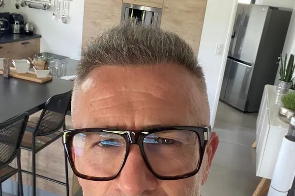 ESTETIVE Greffe de Cheveux - Resim 14