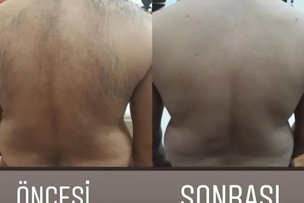 Etiler Kuaför Güzellik Bakım Salon Lazer Epilasyon - Resim 8