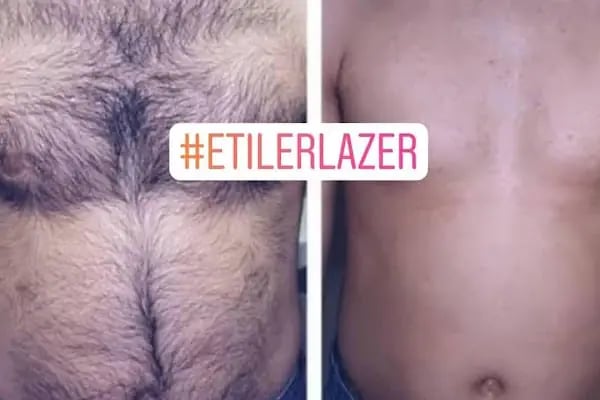 Etiler Kuaför Güzellik Bakım Salon Lazer Epilasyon - Resim 9