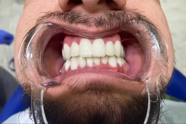 Newadent Ağız ve Diş Sağlığı Polikliniği - Resim 7