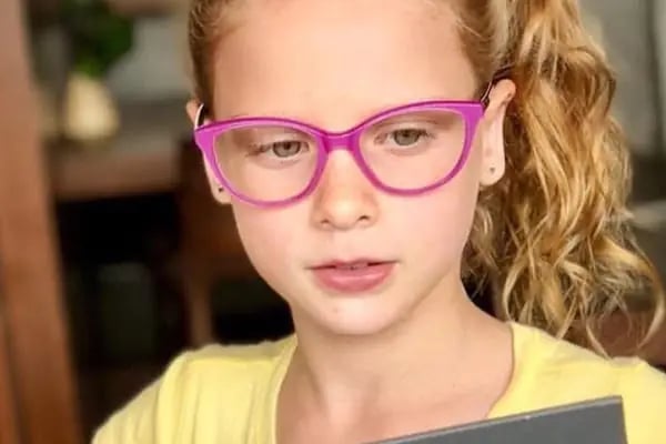 Fad Optik Lens - Resim 8