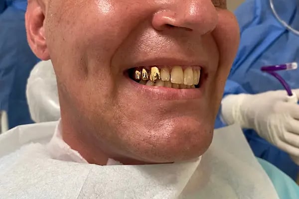 Dental Ata Clinic - Alanya Diş Polikliniği - Resim 19
