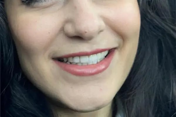Dental Ata Clinic - Alanya Diş Polikliniği - Resim 12