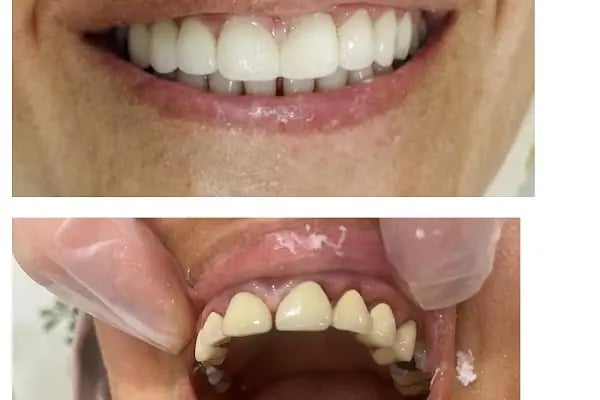 Dental Ata Clinic - Alanya Diş Polikliniği - Resim 14