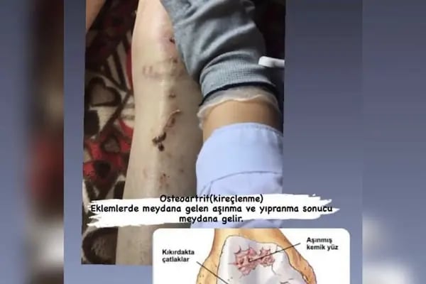 DOĞU MERİDYEN TERAPİ - Resim 9