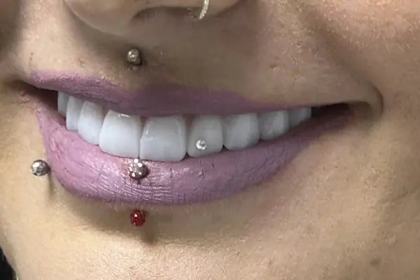 DentalExpertsTurkey | Özel Venta Klinik Ağız ve Diş Sağlığı Polikliniği - Resim 10