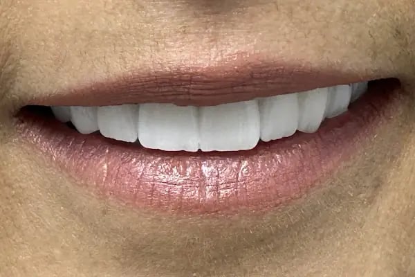 DentalExpertsTurkey | Özel Venta Klinik Ağız ve Diş Sağlığı Polikliniği - Resim 3