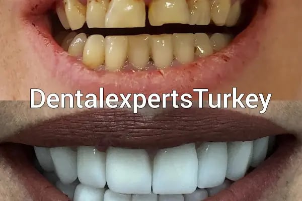 DentalExpertsTurkey | Özel Venta Klinik Ağız ve Diş Sağlığı Polikliniği - Resim 2