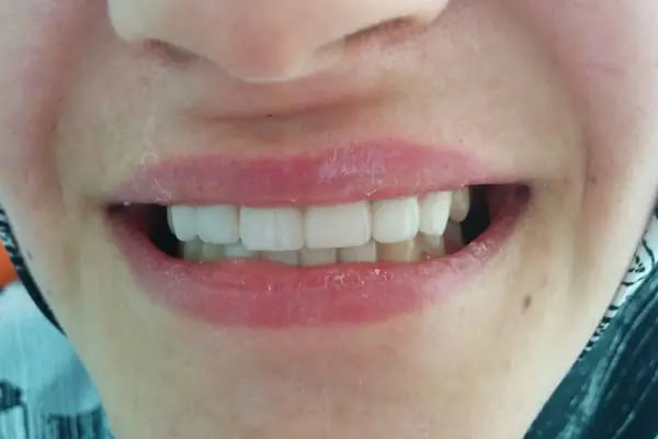Pident Ağız ve Diş Sağlığı Polikliniği - Resim 4