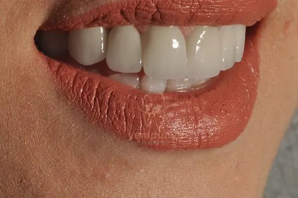 Özel Yeni Dünya Ağız ve Diş Sağlığı Polikliniği - Resim 14