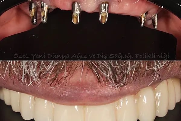 Özel Yeni Dünya Ağız ve Diş Sağlığı Polikliniği - Resim 19