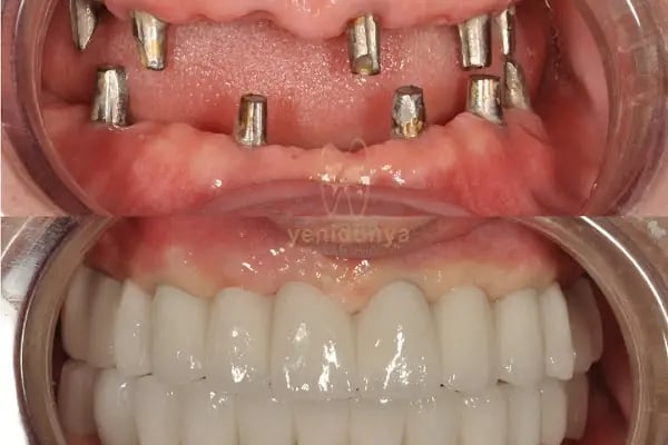 Özel Yeni Dünya Ağız ve Diş Sağlığı Polikliniği - Resim 20