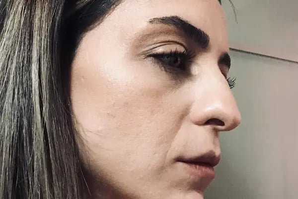 Op. Dr. Murat Diyarbakırlıoğlu Estetik Plastik Rekonstrüktif Cerrahi Uzmanı - Resim 4