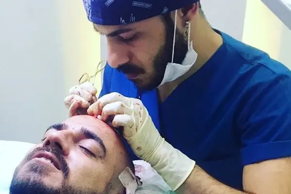 izmirhair Saç Ekim ve Estetik Merkezi - Resim 8