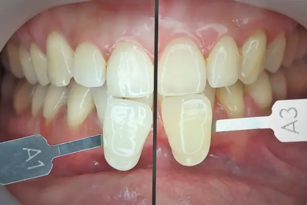 Uzm.Dr. Nurhal Mercan Bozkurt Dermatoloji&amp;Kozmetoloji Kliniği - Resim 17