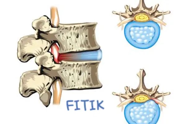 FİZYOSANTE FİZYOTERAPİ VE PİLATES MERKEZİ - Resim 3