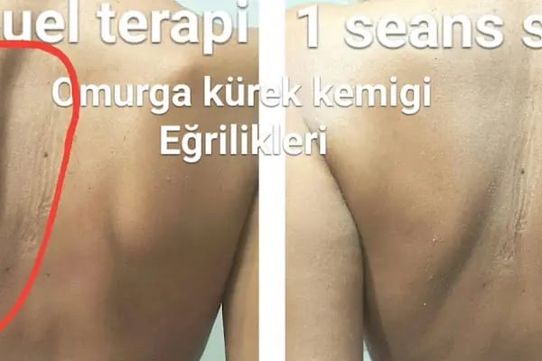 FİZYOSANTE FİZYOTERAPİ VE PİLATES MERKEZİ - Resim 12