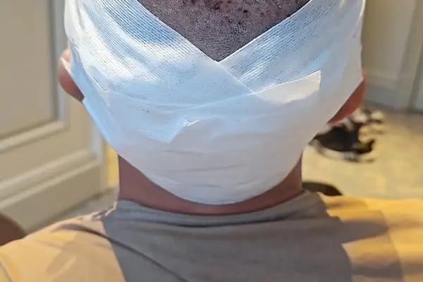 Doç. Dr. Tayfun Bilgiç - Obezite Cerrahisi - Kolorektal Cerrahi &amp; Proktoloji - Resim 11