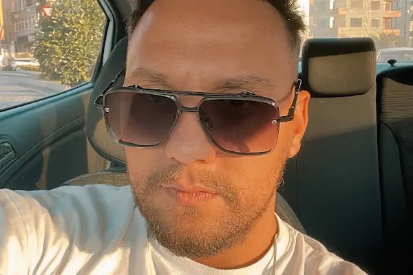 Master Hair Transplant - Resim 5