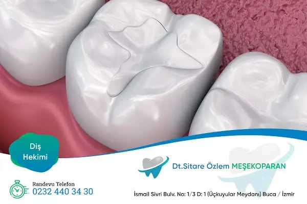 Diş Hekimi Sitare Özlem Meşekoparan - Resim 19