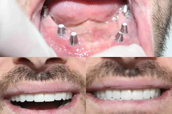 Özel Dicle Dent Diş Kliniği - Resim 8