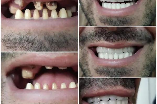 Özel Dicle Dent Diş Kliniği - Resim 11