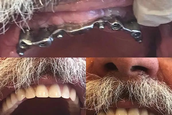 Özel Dicle Dent Diş Kliniği - Resim 2