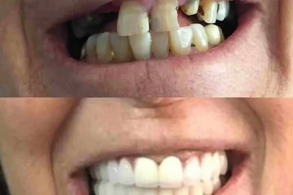 Özel Dicle Dent Diş Kliniği - Resim 7