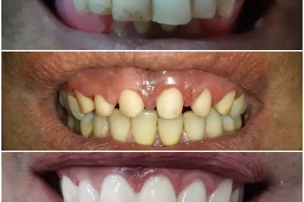 Özel Dicle Dent Diş Kliniği - Resim 6