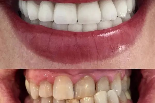 Özel Dicle Dent Diş Kliniği - Resim 4