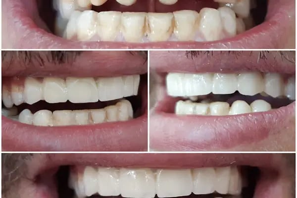 Özel Dicle Dent Diş Kliniği - Resim 3