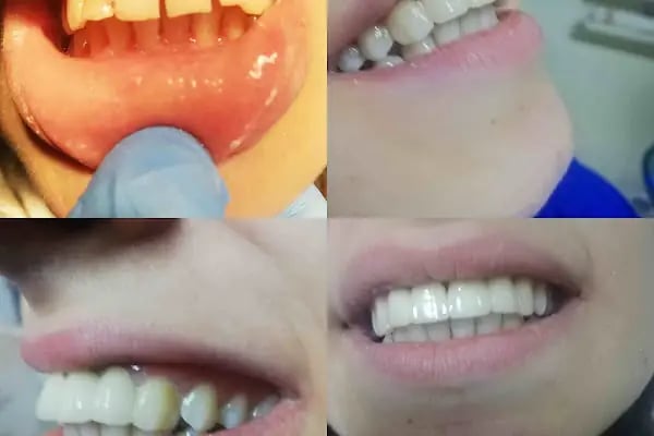 Özel Dicle Dent Diş Kliniği - Resim 10