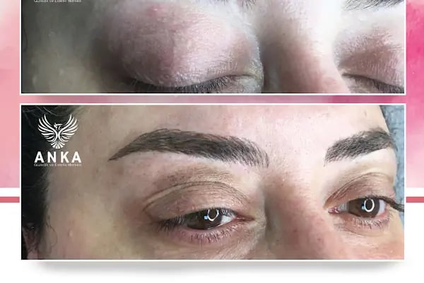 Anka Güzellik ve Estetik Merkezi - Bursa Güzellik Merkezi - Anka Güzellik Salonu - Resim 7