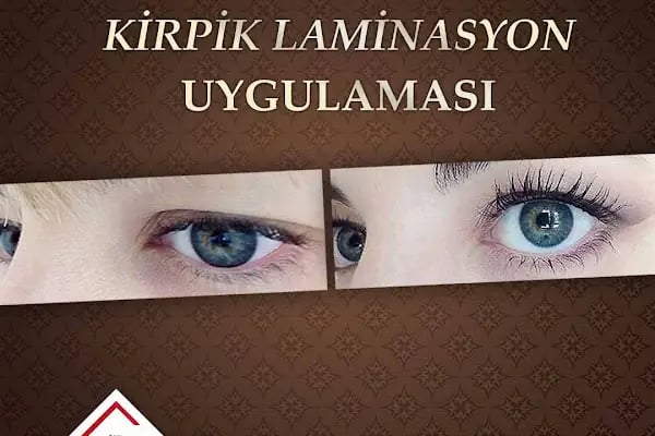 estetik medikal poliklinik Özel Trim Sağlık Polikliniği - Resim 13