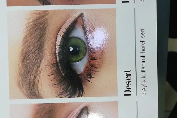 Etkin Optik - Resim 4