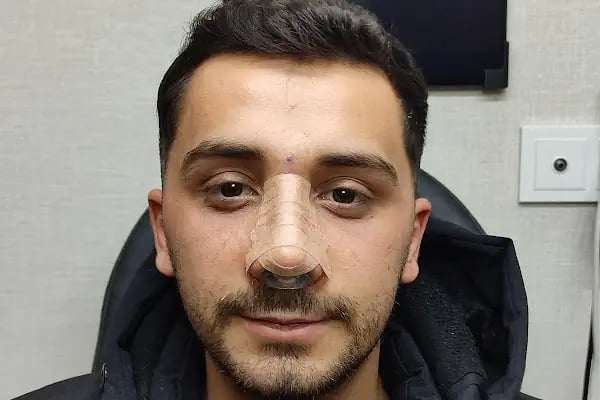 Doç. Dr. Bilal Sizer Muayenehanesi - Resim 14