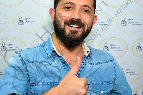 Hasan Demir Saç Ekimi Ankara - Resim 15