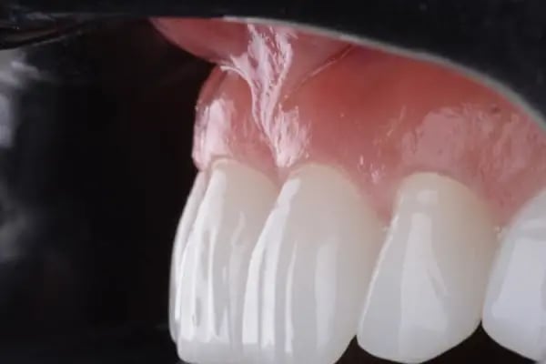 Klinik Adana Diş Polikliniği - Resim 20