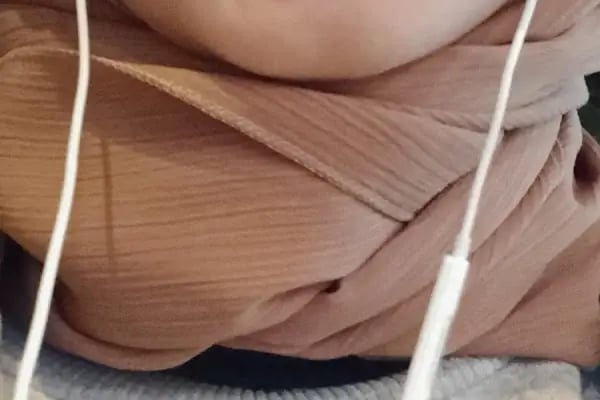Klinik Adana Diş Polikliniği - Resim 17