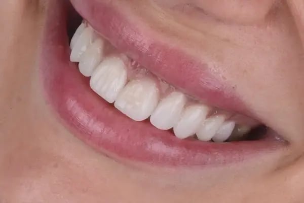 Klinik Adana Diş Polikliniği - Resim 14