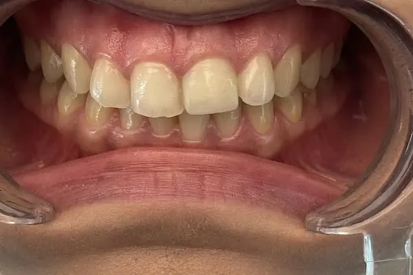 Klinik Adana Diş Polikliniği - Resim 12