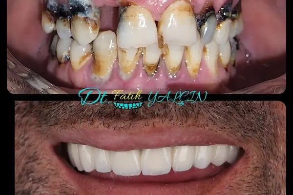 Özel Doğa Dent Ağız ve Diş Sağlığı Polikliniği Gaziantep - Resim 17
