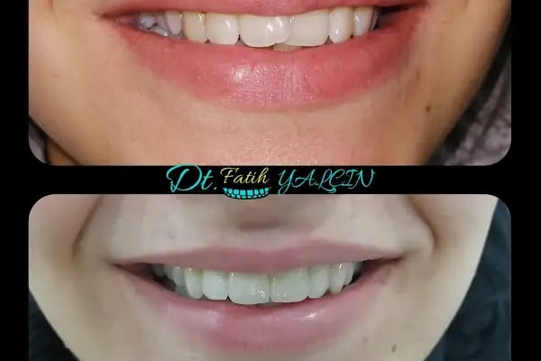Özel Doğa Dent Ağız ve Diş Sağlığı Polikliniği Gaziantep - Resim 18